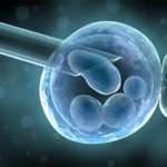 Що таке пункція фолікулів при ЕКЗ і як вона відбувається