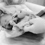 Форми та методи лікування гіпоспадії у хлопчиків