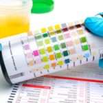 Запах сечі у жінок: причини та особливості виникнення, тактика лікування та прогноз