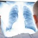 Мікоплазма як причина пневмонії у дітей: захворюваність, методи терапії,