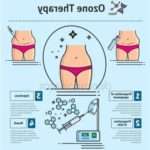 Як працює озонотерапія для схуднення