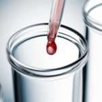 Причини підвищення коефіцієнта атерогенності у жінок в крові та методи зниження