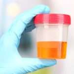 Як зібрати сечу у немовляти: особливості, способи