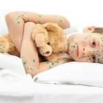 Потрібно ставити щеплення від вітрянки дітям