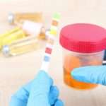 Навіщо проводять аналіз сечі за Зимницьким