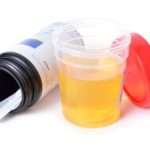 Причини появи ацетону в сечі у дитини і способи його зниження