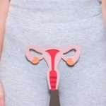 Види коагуляций шийки матки: показання та протипоказання, реабілітація