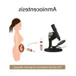 Необхідність проведення амніоцентезу при вагітності та показання до процедури