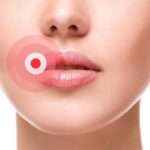 Небезпечний герпес на губах при вагітності