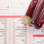 Еозинофіли у жінок: норма і причини відхилень