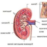 Причини і лікування пієлонефриту у жінок