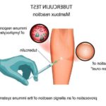 Коли дозволяється мочити манту дитині?