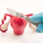 Методика виконання лапароскопії маткових труб