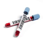 Яке значення wbc в аналізі крові у дитини має бути