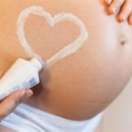 Як підібрати крем для вагітних від розтяжок