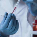 Ревматоїдний фактор у крові: норма у жінок за віком