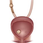 Причини підвищеного вмісту оксалатів у сечі при вагітності