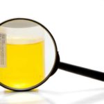 Про що говорить слиз в сечі у жінки?