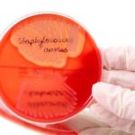 Стафілокок при вагітності: діагностика та лікування