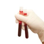 Норма МНО в крові у жінок