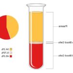 Норма гематокриту у жінок в крові, причини підвищення і пониження