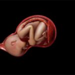 Як впливає вид передлежання на біомеханізм пологів