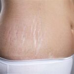 Які масла від розтяжок при вагітності варто використовувати