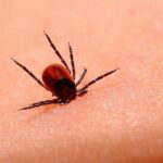 Кліщовий бореліоз у дітей