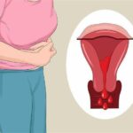 Чому місячні йдуть довше ніж зазвичай