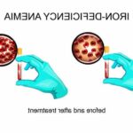 Дефіцит заліза у жінок: причини, ознаки і лікування