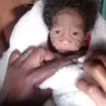 Народилася бабусею: як виглядають діти з хворобою бенджаміна баттона