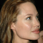 Чому “кути джолі” непомітно перетворюють обличчя в провінційний млинець