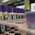 Оспа обезьян: Что нужно знать о симптомах и рисках