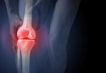 Даремне рентгенівське випромінювання може підштовхнути хворих на артрит до операції