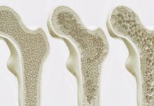 Кістки можуть «тренуватися» без руху: новий шлях до лікування остеопорозу