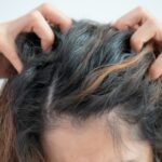 The 12 Most Common Causes of Itchy Scalp, According to Dermatologists