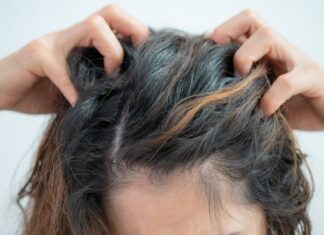 Laut Dermatologen die 12 häufigsten Ursachen für juckende Kopfhaut