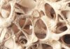 Your Bones Are Quietly Crumbling. Here Is The Fix