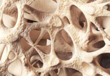 Your Bones Are Quietly Crumbling. Here Is The Fix