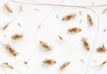 Identifying and treating head lice: A practical guide for women